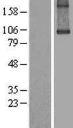 Novus Biologicals™ Transglutaminase 1/TGM1 Overexpression Lysate