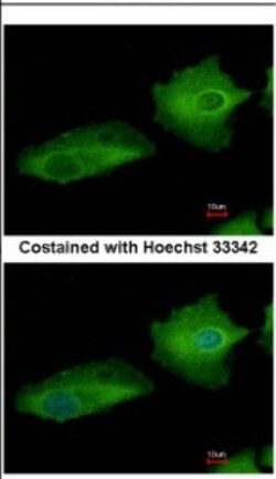 Transglutaminase 2/TGM2 Antibody, Novus Biologicals 0.1mL; Unlabeled:Antibodies,