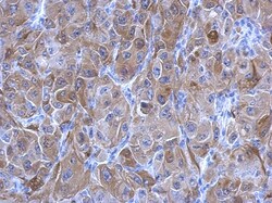 Transglutaminase 2/TGM2 Antibody, Novus Biologicals 0.1mL; Unlabeled:Antibodies,