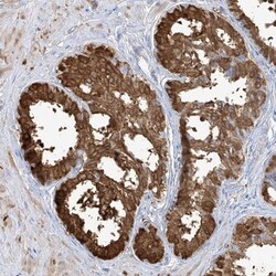 Transglutaminase 4/TGM4 Antibody, Novus Biologicals 0.1mL; Unlabeled:Antibodies,