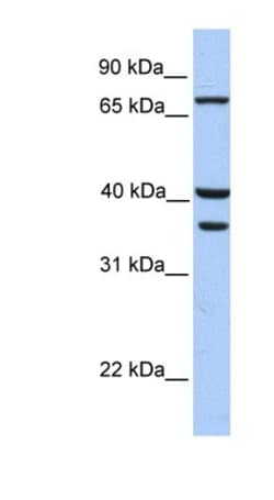 Transglutaminase 5 Antibody, Novus Biologicals 100&mu;L; Unlabeled:Antibodies,