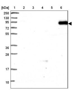 Transglutaminase 1/TGM1 Antibody, Novus Biologicals 0.1mL; Unlabeled:Antibodies,