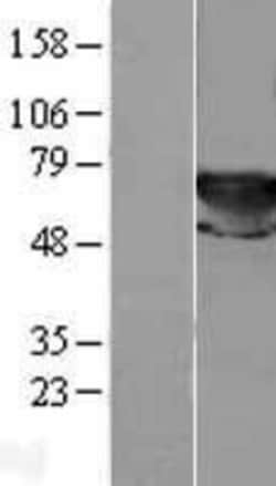 Novus Biologicals™ Transketolase Overexpression Lysate