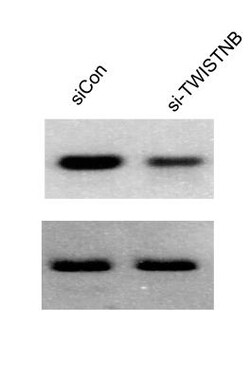 Transketolase Antibody, Novus Biologicals 0.1mL; Unlabeled:Antibodies,
