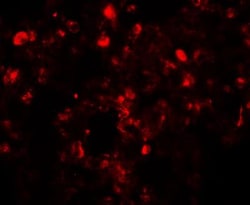 Translin Antibody - BSA Free, Novus Biologicals 0.1mg; Unlabeled:Antibodies,