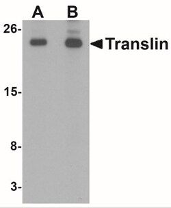 Translin Antibody - BSA Free, Novus Biologicals 0.1mg; Unlabeled:Antibodies,
