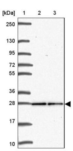 Translin Antibody, Novus Biologicals 0.1mL; Unlabeled:Antibodies, Polyclonal
