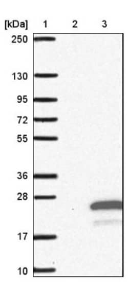 TMEM 138 Antibody, Novus Biologicals:Antibodies:Primary Antibodies