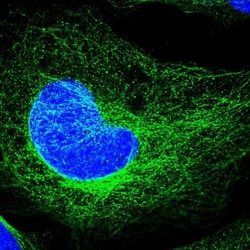 TMEM 138 Antibody, Novus Biologicals:Antibodies:Primary Antibodies
