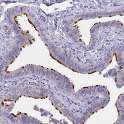 TMEM 138 Antibody, Novus Biologicals:Antibodies:Primary Antibodies