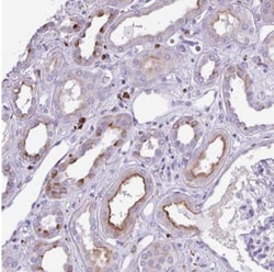TMEM200C Antibody, Novus Biologicals 0.1mL; Unlabeled:Antibodies, Polyclonal