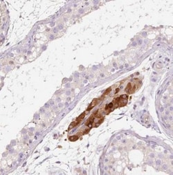 TMEM235 Antibody, Novus Biologicals 0.1mL; Unlabeled:Antibodies, Polyclonal