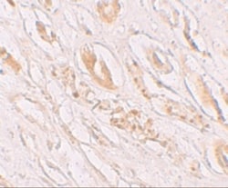 TMEM59 Antibody - BSA Free, Novus Biologicals 0.1mg; Unlabeled:Antibodies,