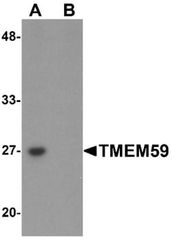 TMEM59 Antibody - BSA Free, Novus Biologicals 0.1mg; Unlabeled:Antibodies,
