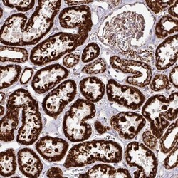 TRAP1 Antibody, Novus Biologicals 0.1mL; Unlabeled:Antibodies, Polyclonal