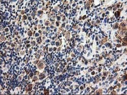 TRAP alpha Antibody (OTI4C7), Novus Biologicals 0.1mL; Unlabeled:Antibodies,