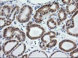 TRAP alpha Antibody (OTI4C7), Novus Biologicals 0.1mL; Unlabeled:Antibodies,