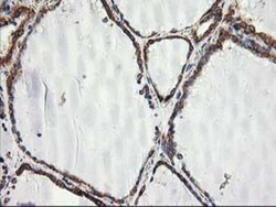 TRAP alpha Antibody (OTI4C7), Novus Biologicals 0.1mL; Unlabeled:Antibodies,