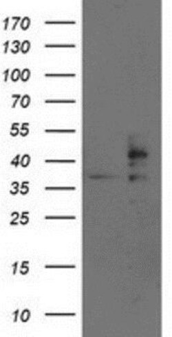 TRAP alpha Antibody (OTI4C7), Novus Biologicals 0.1mL; Unlabeled:Antibodies,