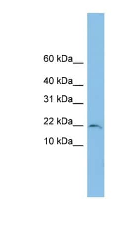 TRAPPC1 Antibody, Novus Biologicals:Antibodies:Primary Antibodies