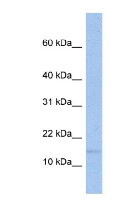 TRAPPC2 Antibody, Novus Biologicals:Antibodies:Primary Antibodies