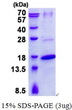 Novus Biologicals&trade;&nbsp;Recombinant Human TRAPPC2 His Protein