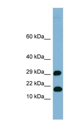 TRAPPC2L Antibody, Novus Biologicals 100&mu;L; Unlabeled:Antibodies, Polyclonal