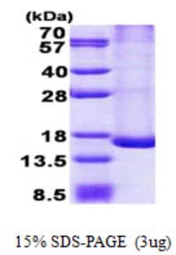 Novus Biologicals&trade;&nbsp;Recombinant Human TRAPPC2L His Protein
