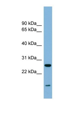 TRAPPC4 Antibody, Novus Biologicals:Antibodies:Primary Antibodies