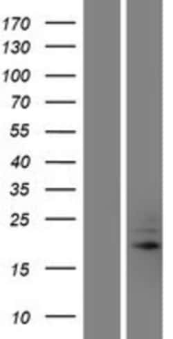 Novus Biologicals&trade;&nbsp;TRAPPC5 Overexpression Lysate