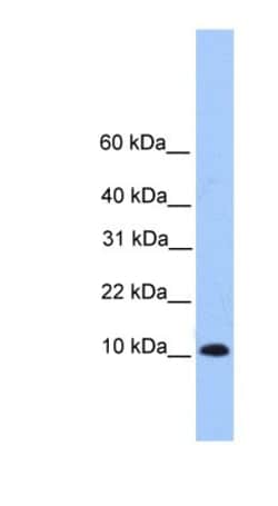 TRAPPC6B Antibody, Novus Biologicals 100 &mu;L | Buy Online | Novus Biologicals | Fisher Scientific