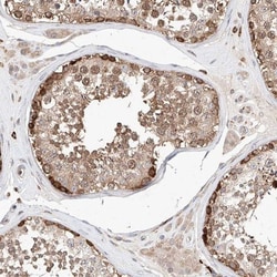 TRAX Antibody, Novus Biologicals 25 &mu;L; Unlabeled:Antibodies, Polyclonal