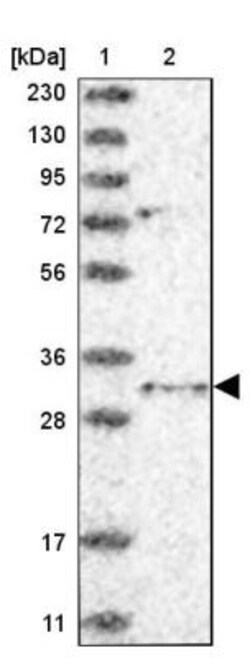 TRAX Antibody, Novus Biologicals 25 &mu;L; Unlabeled:Antibodies, Polyclonal