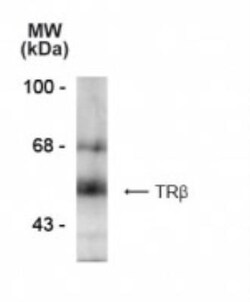 TR beta 1/NR1A2/Thyroid Hormone Receptor beta Antibody (2386), Novus Biologicals