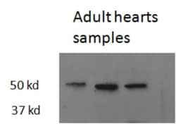 TR beta 1/NR1A2/Thyroid Hormone Receptor beta Antibody, Novus Biologicals