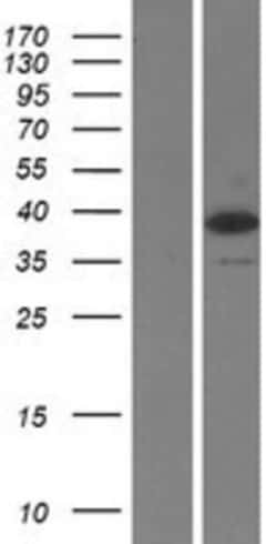 Novus Biologicals™ TRBP Overexpression Lysate