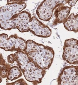 TRBP Antibody, Novus Biologicals:Antibodies:Primary Antibodies