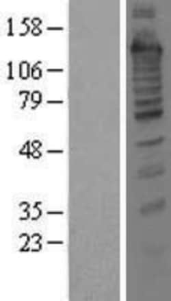 Novus Biologicals&trade;&nbsp;Treacher Collins syndrome protein Overexpression Lysate