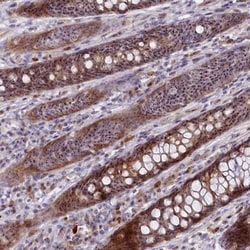 Treacher Collins syndrome protein Antibody, Novus Biologicals 0.1mL; Unlabeled:Antibodies,