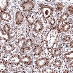 Treacher Collins syndrome protein Antibody, Novus Biologicals 0.1mL; Unlabeled:Antibodies,