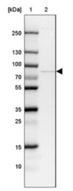 Treacher Collins syndrome protein Antibody, Novus Biologicals 0.1mL; Unlabeled:Antibodies,