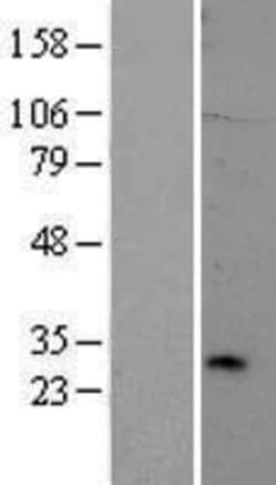 Novus Biologicals&trade;&nbsp;TREM2 Overexpression Lysate