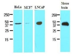 TREM2 Antibody (2B5) - BSA Free, Novus Biologicals 0.1mL; Unlabeled:Antibodies,