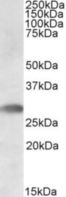 TREML1/TLT-1 Antibody, Novus Biologicals 0.1mg; Unlabeled:Antibodies, Polyclonal