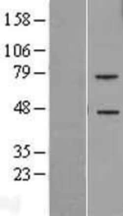 Novus Biologicals™ TREML2/TLT-2 Overexpression Lysate