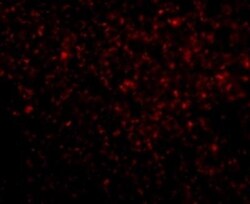 TREX1 Antibody - BSA Free, Novus Biologicals 0.1mg; Unlabeled:Antibodies,