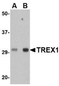 TREX1 Antibody - BSA Free, Novus Biologicals 0.1mg; Unlabeled:Antibodies,