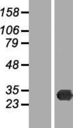 Novus Biologicals&trade;&nbsp;TREX2 Overexpression Lysate