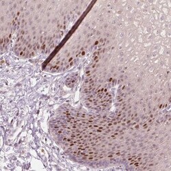 TREX2 Antibody, Novus Biologicals:Antibodies:Primary Antibodies