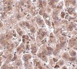 TREX2 Antibody - BSA Free, Novus Biologicals 0.1mg; Unlabeled:Antibodies,